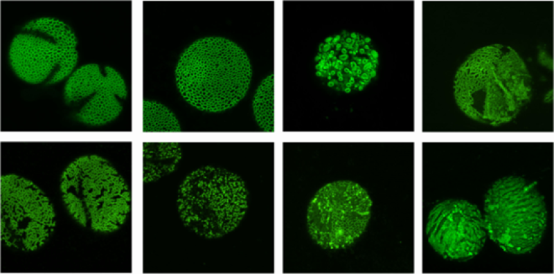 Figure 3. Examples of phenotypes of our exine and aperture Arabidopsis mutants.