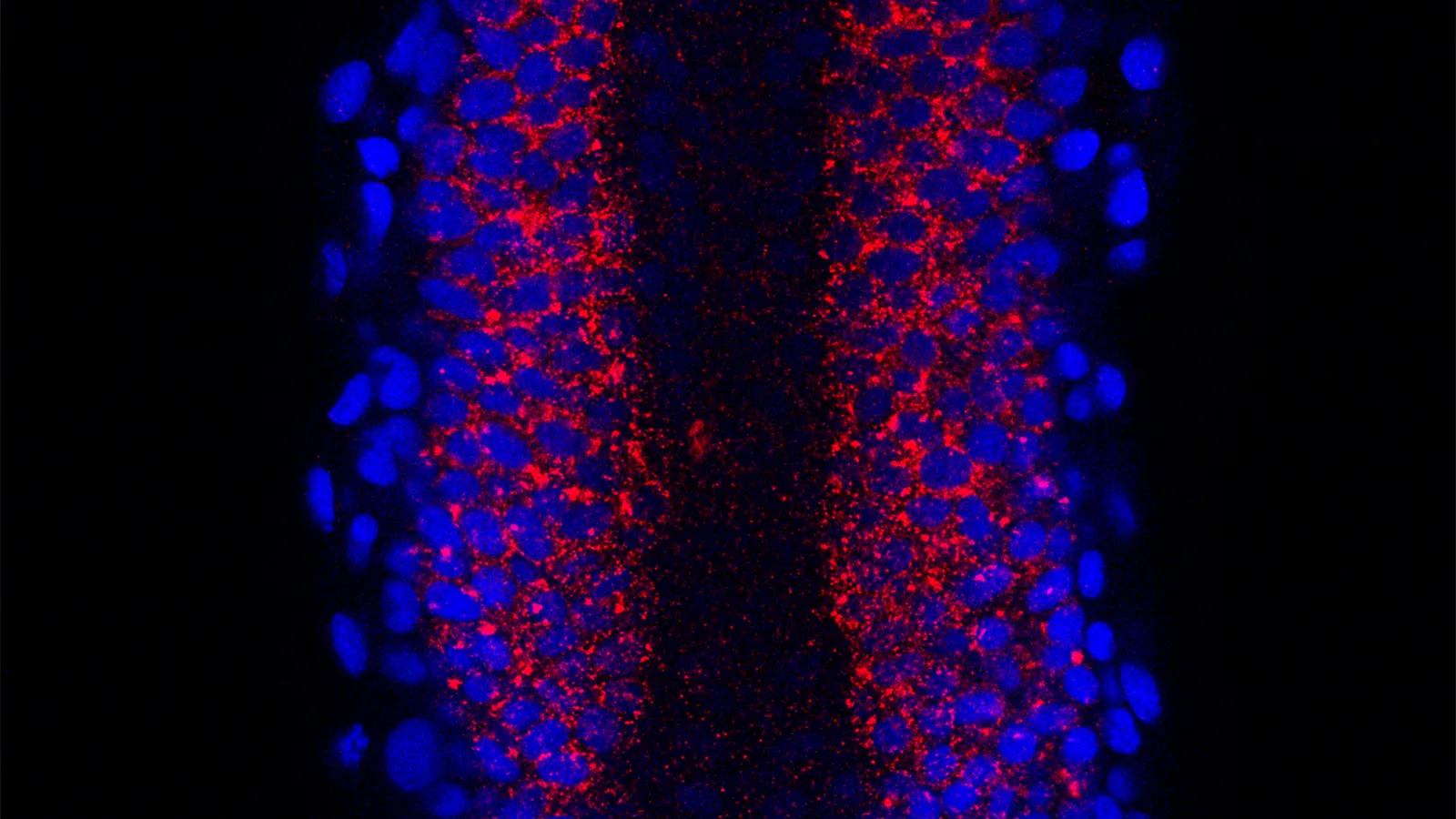 Photo of research from the Amacher Lab Researcher Tom Gallagher