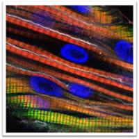 "Art of Cancer Research" competition for "Eyeing the Muscle"