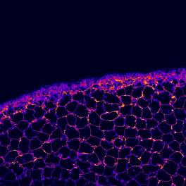Confocal image of the surface of a mouse lens
