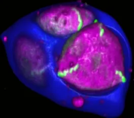 Figure 2. Exine deposition in developing pollen.