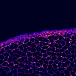 Confocal image of the surface of a mouse lens