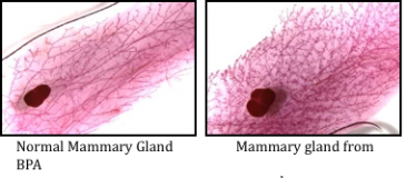 Mammary Glands Normal mammary gland vs. mammary gland exposed to BPA